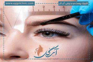 کاشت ابرو در تهران با بهترین نتیجه | رشد دائمی + زیبایی بینظیر