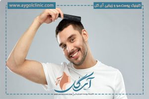 بهترین روش کاشت مو چیست؟