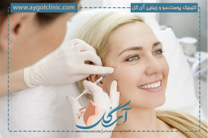بوتاکس دور چشم و پیشانی؛ 6 نکته مهم