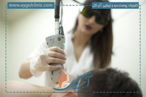 لیزر الکساندرایت کندلا چیست و چه مزیت هایی دارد؟