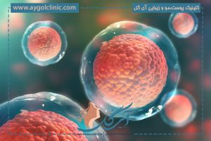 کاشت مو به روش سلول‌های بنیادی: راهی نوین برای بازگشت موها