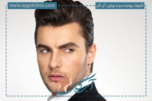 روش‌های نوین و موثر برای افزایش تراکم کاشت مو
