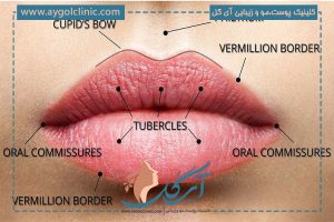 راهنمای کامل تزریق فیلر لب طبیعی: فرآیند، مزایا و مراقبتها