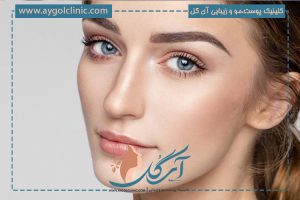 لیفت پلک بدون جراحی با استفاده از دستگاه پلاسماجت