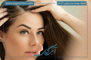کاشت موی جلوی سر زنان؛ روش‌ها، مراقبت‌ها، هزینه و مزایا