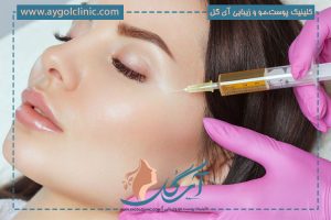 ماندگارترین روش چاقی صورت چیست؟ روش‌های سنتی و پزشکی