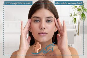 بهترین سن برای عمل بلفاروپلاستی پلک بالا و پایین