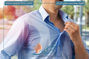 تزریق بوتاکس زیر بغل؛ بهترین درمان برای تعریق زیاد