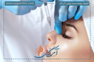 تزریق فیلر بینی برای بینی گوشتی مناسب نیست (مگر یک مورد!)