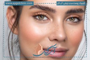 هزینه کاشت ابرو در سال ۱۴۰۵؛ چه عواملی قیمت کاشت ابرو را تعیین می‌کنند؟