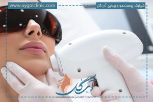 چند روز بعد از لیزر موها میریزد؟ (جدول دقیق زمانی)