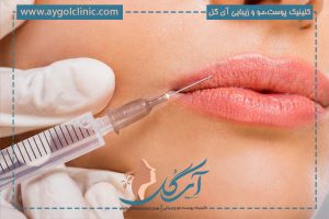 فیلر و بوتاکس چیست؟ و چه تفاوتی با هم دارند؟