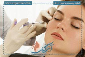 ماندگاری فیلر زیر چشم چقدر است؟ + راه های افزایش ماندگاری