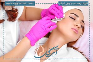 مزوتراپی صورت + مواد قابل استفاده و میزان ماندگاری آن