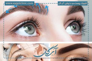 منظور از کاشت ابرو بدون جراحی چیست؟ + نحوه انجام آن را بشناسید!