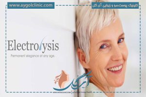 الکترولیز موهای سفید چیست؟ تفاوت آن با لیزر موهای زائد