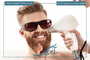 انجام لیزر خط ریش برای آنکارد کردن صورت آقایان