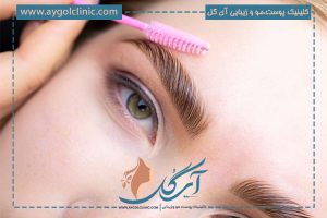 کاشت ابرو بدون جراحی در تهران | (عکس قبل و بعد + قیمت ویژه) ✨