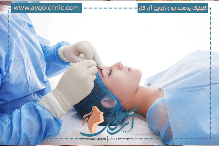 کلینیک آی گل بهترین مرکز تخصصی جراحی بلفاروپلاستی در تهران