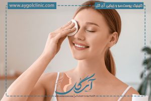 دوره نقاهت بلفاروپلاستی چند روز است؟ + جدول زمانی و نکات مهم