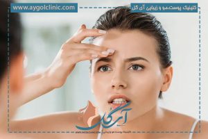 عوارض کاشت ابرو؛ در صورت مراجعه به کلینیک‌های غیر تخصصی