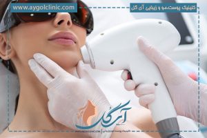 لیزر با دستگاه اشنایدر پلاس؛ تکنولوژی جدید، بهترین نتیجه 