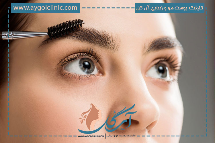 پروسه کار و روش های کاشت ابرو