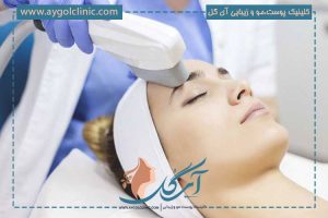 آی پی ال: کاربرد، مراقبت‌ها، مزایا و ممنوعیت‌ها