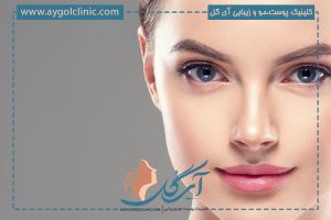 بلفاروپلاستی چشم گربه‌ای | مشاوره و رزرو نوبت جراحی + قیمت ۱۴۰۵ 🐱