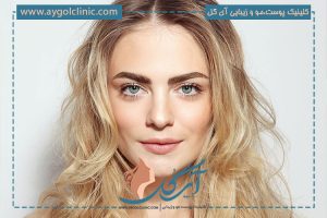 انواع روش های کاشت ابرو + مزایا و معایب هر کدام