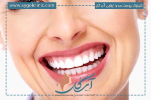 بوتاکس لبخند لثه‌ای؛ راه‌حل سریع برای لبخندی متعادل