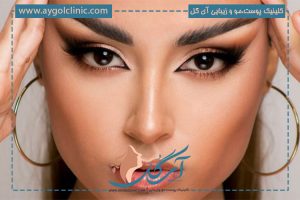 بلفاروپلاستی چشم روباهی | چشم‌های زیبا و بادامی + بدون عوارض 🦊