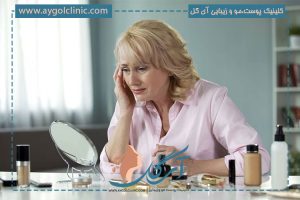  نحوه درمان افتادگی پوست صورت + معرفی 7 روش موثر لیفت پوست