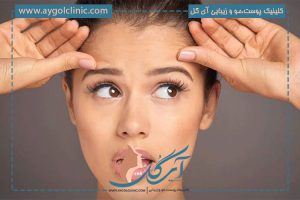 درمان عفونت بعد از کاشت ابرو و راه های پیشگیری از این عارضه