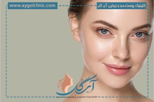 رفع پف بالای چشم: روش‌های خانگی و کلینیکی + چرا چشم پف می‌کند؟