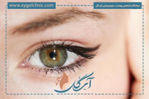 مراقبت‌های بعد از تزریق فیلر زیر چشم + ممنوعیت‌ها و هشدارها