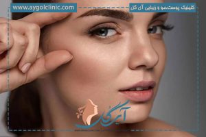 نتیجه کاشت ابرو بعد از یکسال و عواملی که روی آن تاثیر دارند