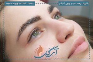 کاشت ابرو به روش FUE چگونه است و چه تفاوتی با روش FUT دارد؟