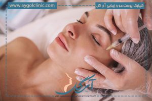 فیلر زیر چشم چیست؟ عوارض، انواع و کاربردهای فیلر زیر چشم