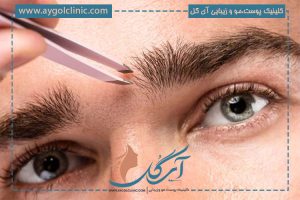 میکروبلیدینگ چیست؟ مراقبت + ماندگای + مراحل انجام