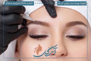 کاشت ابرو چند ساعت طول میکشد؟ + مدت زمان دوره نقاهت ابرو