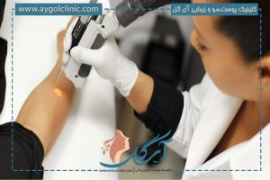 شات لیزر روشی نوین و برتر برای از بین بردن موهای زائد بدن
