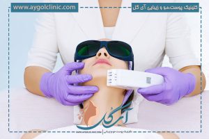 نکات مهم برای جلوگیری از تیرگی پوست بعد از لیزر درمانی