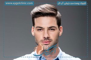 ریزش مو بعد از کاشت: علت‌ها، دلایل و روش‌های پیشگیری از آن