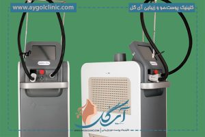 بین دستگاه لیزر شاتی و رولی کدام یک را انتخاب کنیم؟  