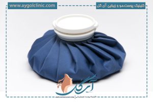 اهمیت کمپرس یخ بعد از عمل بلفاروپلاستی برای کاهش تورم و کبودی