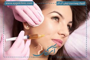 دلیل گلوله شدن ژل خط خنده: چگونه این مشکل را رفع کنیم؟