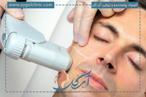 دستگاه های جوانسازی پوست معجزه ای برای به تعویق انداختن روند پیری