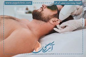 لیزرموهای زائد گوش و بینی برای رهایی از موهای زائد آزاردهنده