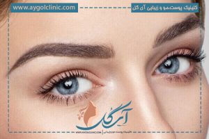 تتو ابرو: مزایا، معایب و مقایسه با کاشت ابرو بدون جراحی